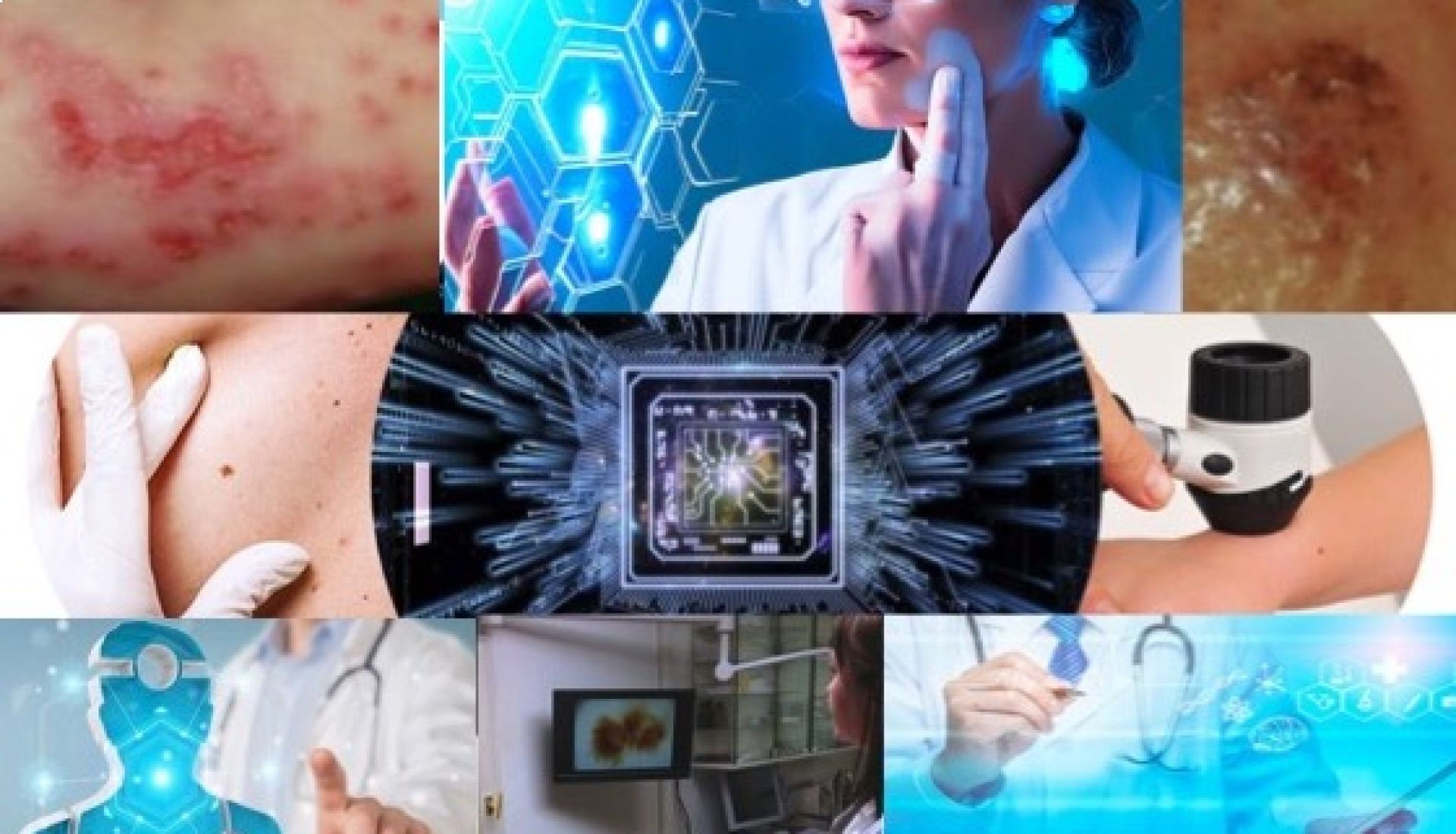 L'INTELLIGENCE ARTIFICIELLE AU SERVICE DE LA DERMATOLOGIE